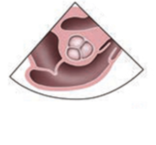 TEE Learning Platform - Interactive Transesophageal Echocardiography ...